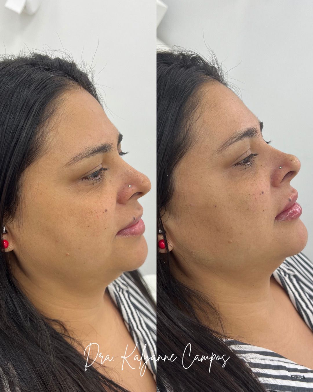 Serviço Realizado